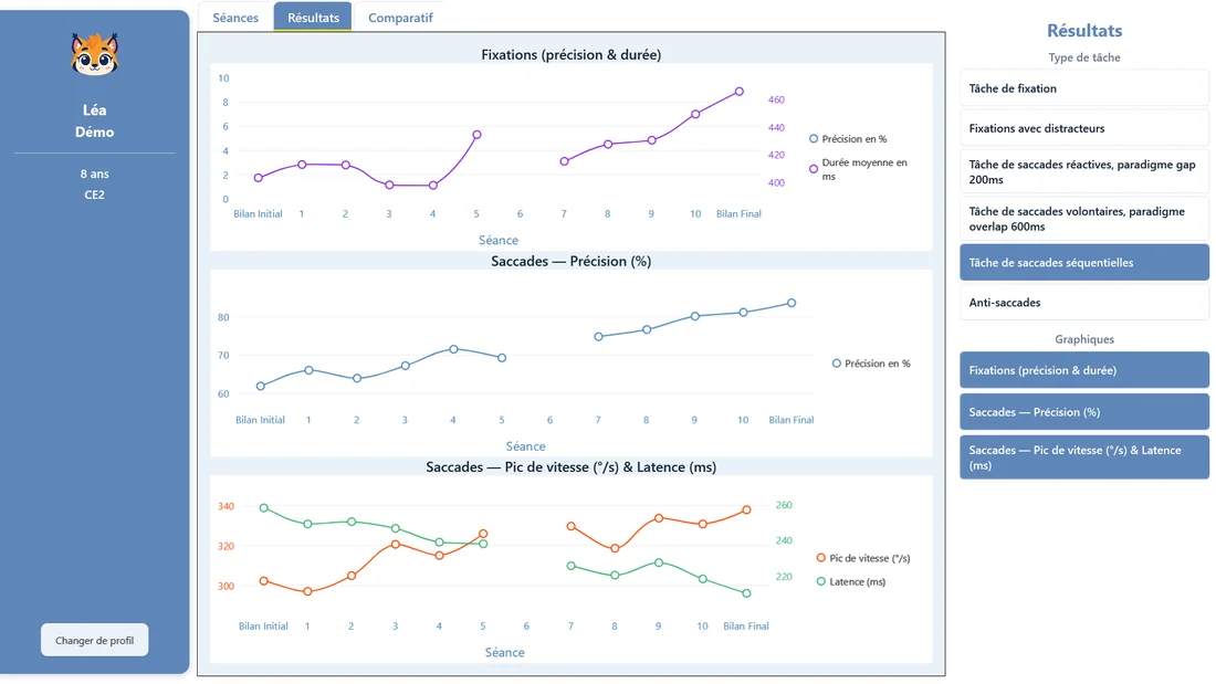 Interface du prototype Oculolab : courbes de fixations, de saccades, de pic de vitesse et de latence, sur un profil de démonstration fictif